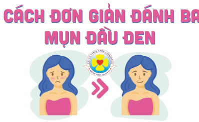 6 cách đơn giản đánh bay mụn đầu đen